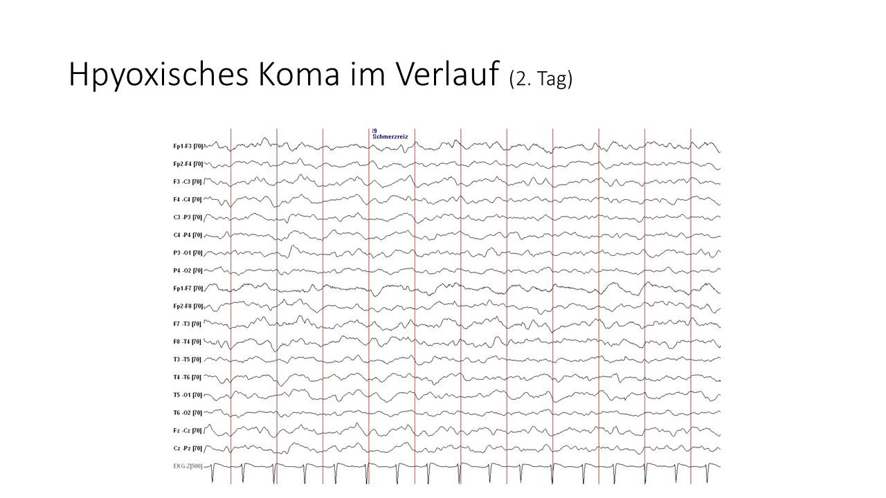 folie430.jpg