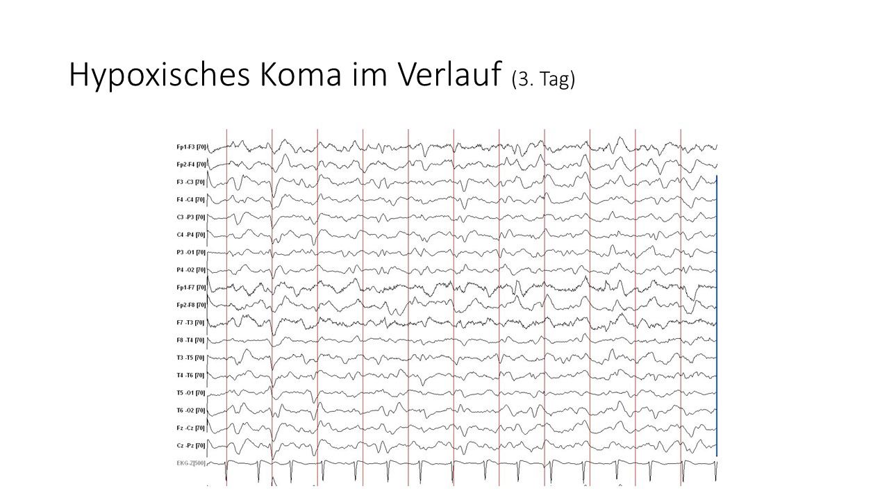 folie431.jpg